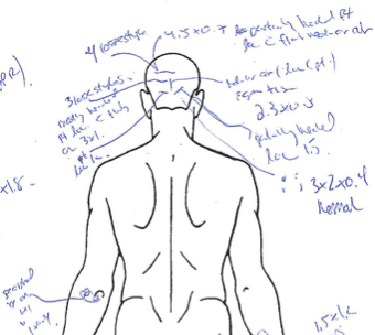 A partial diagram from Adena’s autopsy report. The report documents extensive injuries sustained during his time in jail.